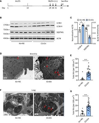 Autophagy Promotes Cigarette Smoke-Initiated and Elastin-Driven Bronchitis-Like Airway Inflammation in Mice